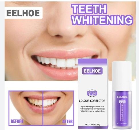 30ml%20Toothpaste%20Teeth%20Whitening%20Remove%20Food%20Particles%20and%20deep%20Stains(V34)%20-%20Image%204