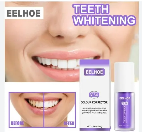 30ml%20Toothpaste%20Teeth%20Whitening%20Remove%20Food%20Particles%20and%20deep%20Stains(V34)%20-%20Image%204