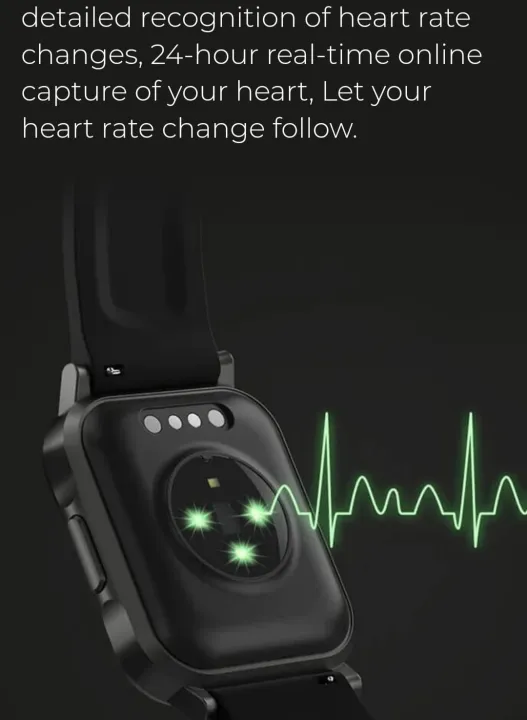 Haylou%20LS02%201.4%20inch%20Large%20HD%20Screen%20Smart%20Watch%20-%20Image%205