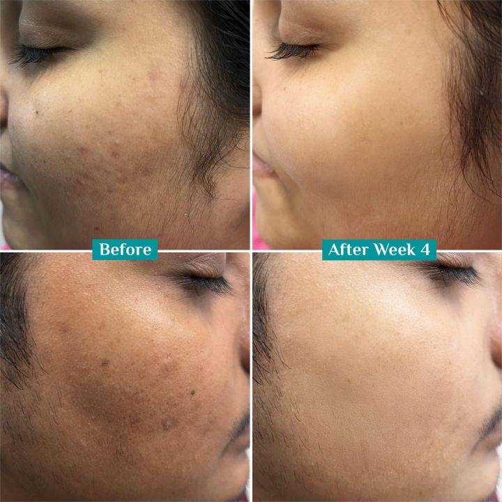 Pilgrim%2010%25%20Vitamin%20C%20Face%20Serum%20with%20Niacinamide,%2030ml%20-%20Image%206