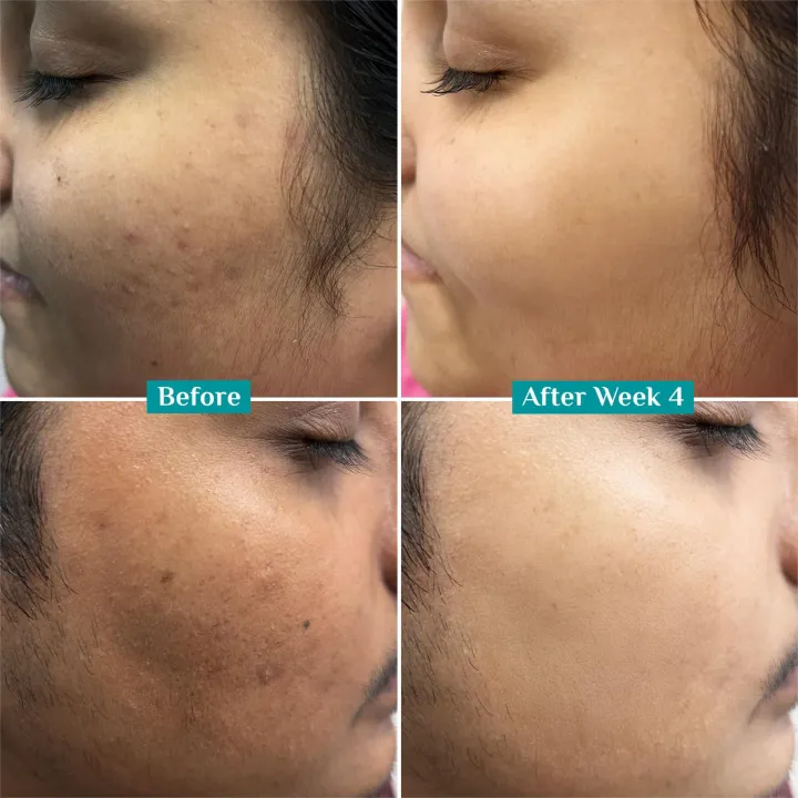 Pilgrim%20Vitamin%20C%20Face%20Serum%2010%25%2030%20Ml%20-%20Image%209