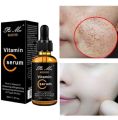 Pei Mei Vitamin C Moisturizing & Anti-Acne Face Serum - 30ml. 