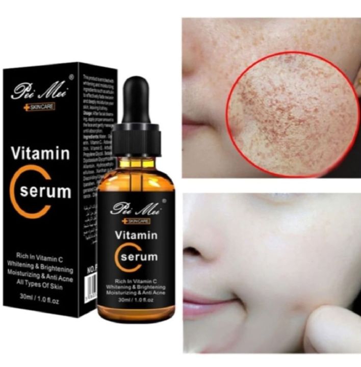 Pei%20Mei%20Vitamin%20C%20Moisturizing%20&%20Anti-Acne%20Face%20Serum%20-%2030ml%20-%20Image%207