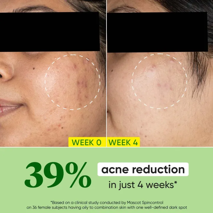 Dot%20&%20Key%20CICA%20Calming%20Skin%20Renewing%20Night%20Gel%20%20with%20Niacinamide,%20Green%20Tea%20&%20Hyaluronic%2060ml%20-%20Image%207