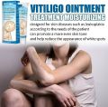 NUTRIG Vitiligo Treatment Cream for White Spots, Vitiligo Cream Treatment Ointment Leucoplia Relief Repair Melanin/20g. 