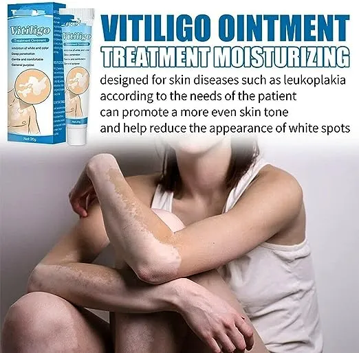 NUTRIG%20Vitiligo%20Treatment%20Cream%20for%20White%20Spots,%20Vitiligo%20Cream%20Treatment%20Ointment%20Leucoplia%20Relief%20Repair%20Melanin/20g%20-%20Image%203
