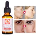 Oznaturals Vitamin C Serum For Face With Hyaluronic Acid - Anti Aging Serum & Hyperpigmentation Treatment With Pure Vitamin E Oil And Rosehip Oil - All Natural Antioxidant Facial And Skin Serum For A Brighter, Even Skin Tone 30 Ml. 