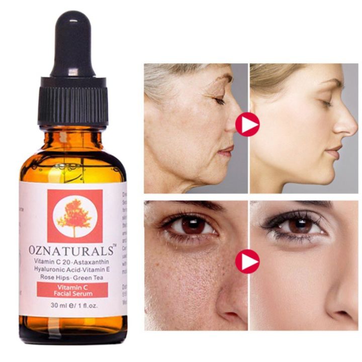 Oznaturals Vitamin C Serum For Face With Hyaluronic Acid - Anti Aging Serum & Hyperpigmentation Treatment With Pure Vitamin E Oil And Rosehip Oil - All Natural Antioxidant Facial And Skin Serum For A Brighter, Even Skin Tone 30 Ml