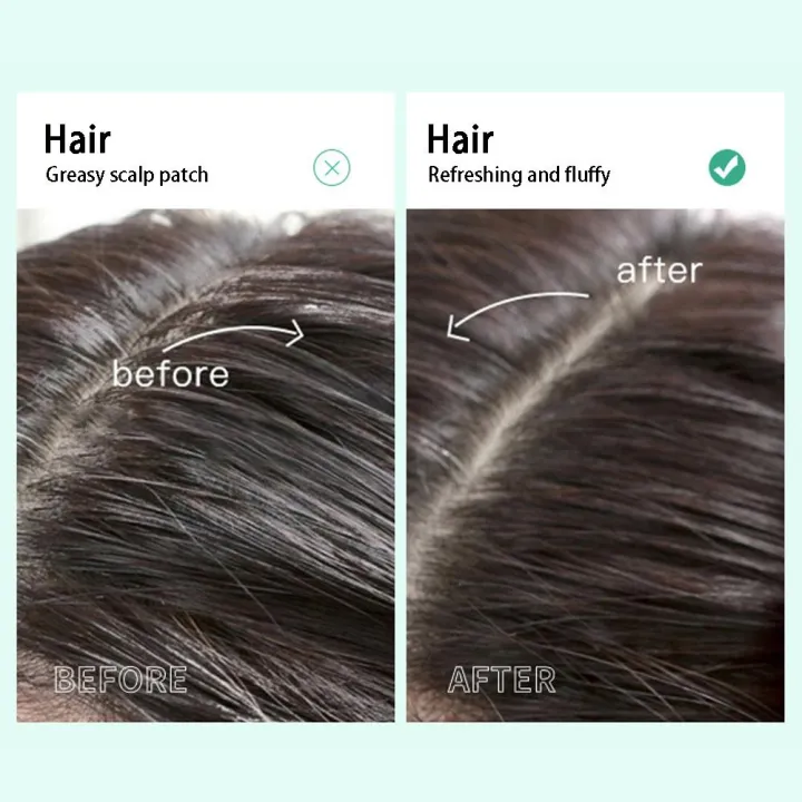 Maigoole%20Scalp%20Shampoo%20Scalp%20Shampoo%20Conditioner%20Deep%20Cleaning%20Scalp%20Refreshing%20Control%20Oil%20For%20Men%20Women%20W3c5%20-%20Image%207