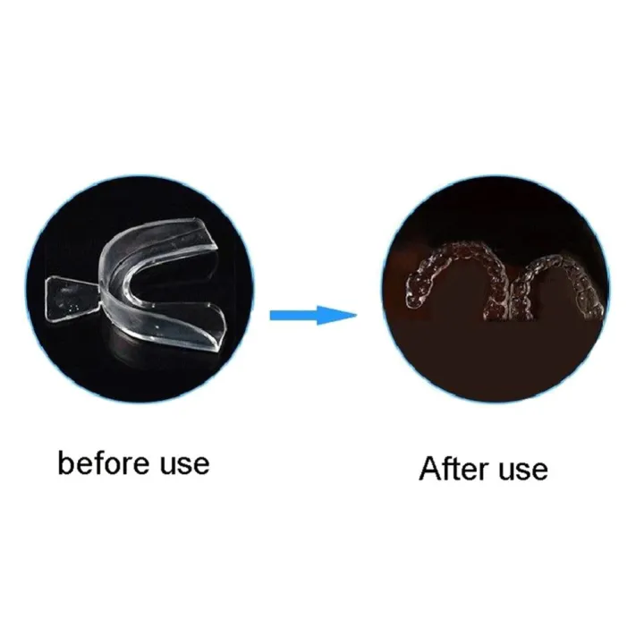 2/4pcs%20Tooth%20Orthodontic%20Appliance%20Trainer%20for%20Alignment%20Braces%20Teeth%20Trainer%20for%20Adults%20Whitening%20Tools%20Transpare%20Family%20Clean%20-%20Image%206