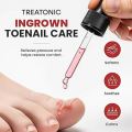 Ingrown Toenail Pain Relief Drops - 30ml. 