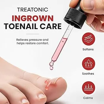 Ingrown%20Toenail%20Pain%20Relief%20Drops%20-%2030ml%20-%20Image%202
