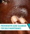 CeraVе Acne Treatment & Control Face Cleanser 237ml (USA). 