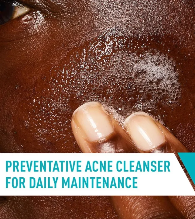 CeraV%D0%B5%20Acne%20Treatment%20&%20Control%20Face%20Cleanser%20237ml%20(USA)%20-%20Image%204