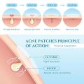 99 Mall Offer 30 PCS Waterproof Salicylic Acid Pimple Patch – Acne Spot Treatment & Skin Repair By 99 Stores. 