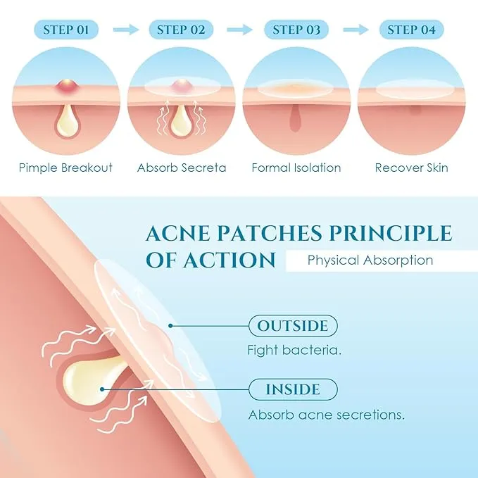 99%20Mall%20Offer%2030%20PCS%20Waterproof%20Salicylic%20Acid%20Pimple%20Patch%20%E2%80%93%20Acne%20Spot%20Treatment%20&%20Skin%20Repair%20By%2099%20Stores%20-%20Image%203