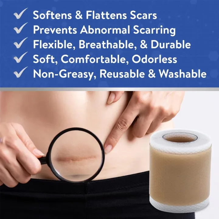 1Roll%20Professional%20Silicone%20Scar%20Sheets%20(Scar%20Tape%20-%20150cm)%20Scars%20Treatment%20-%20Reusable%20Silicone%20Scar%20Strips%20Type%20for%20Keloid,Burn%20-%20Image%205