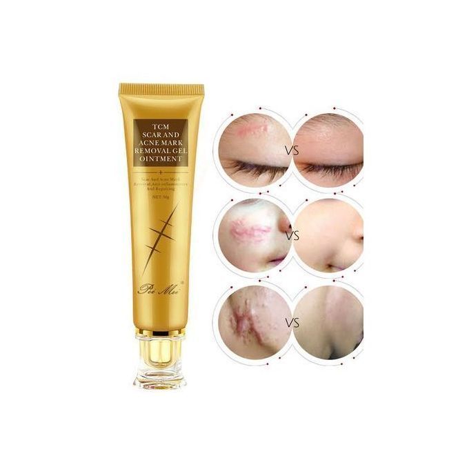 Pei%20Mei%20TCM%20SCAR%20AND%20ACNE%20MARK%20REMOVAL%20GEL%20OINTMENT%2030%20ml%20-%20Image%204