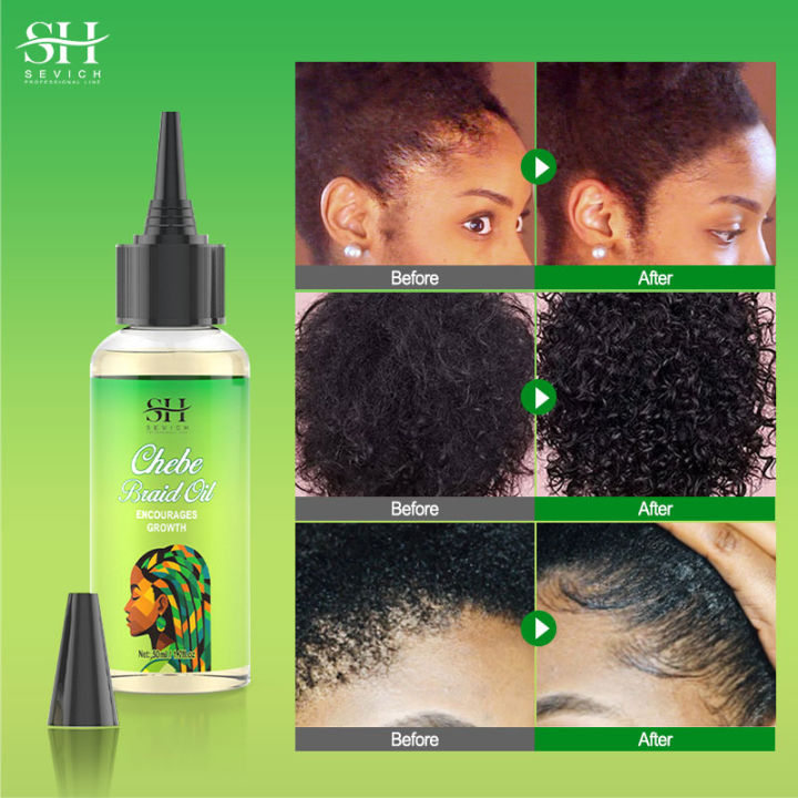 African%20Chebe%20Anti%20Itch%20Braid%20growth%20oil%20For%20Hair%20growth%20Oil%20Healthy%20Scalp%20Spray%20Help%20Soothe%20Dryness%20anti%20hair%20loss%20haircare%20-%20Image%202
