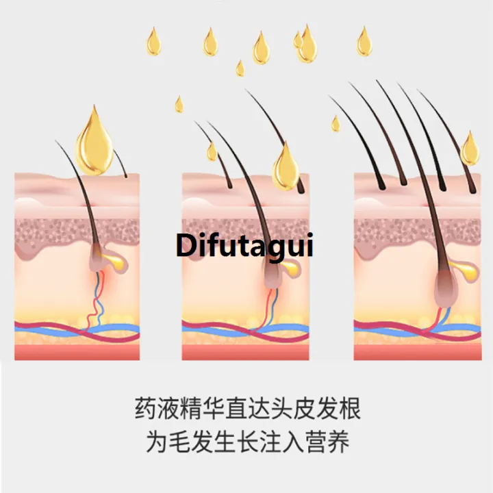 Difutagui%20Mini%20Scalp%20Applicator%20Liquid%20Comb%20for%20Hair%20Scalp%20Treatment%20Serum%202025%20Oil%20Liquid%20Guiding%20Massager%20Comb%20Hair%20Growth%20Serum%20Oil%20Apply%20-%20Image%203