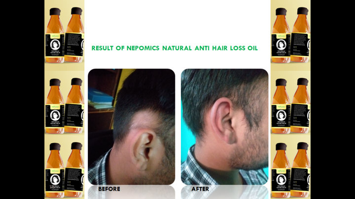 Nepomics%20Natural%20Anti-Hair%20Loss%20Oil-150%20mL%20-%20Image%203