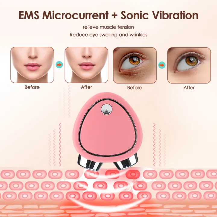 EMS%20Facial%20Massager%20Microcurrent%20Face%20Lift%20Machine%20Roller%20Tightening%20Rejuvenation%20Beauty%20Skin%20Anti%20Wrinkle%20Fat%20Burning%20Slimming%20-%20Image%204