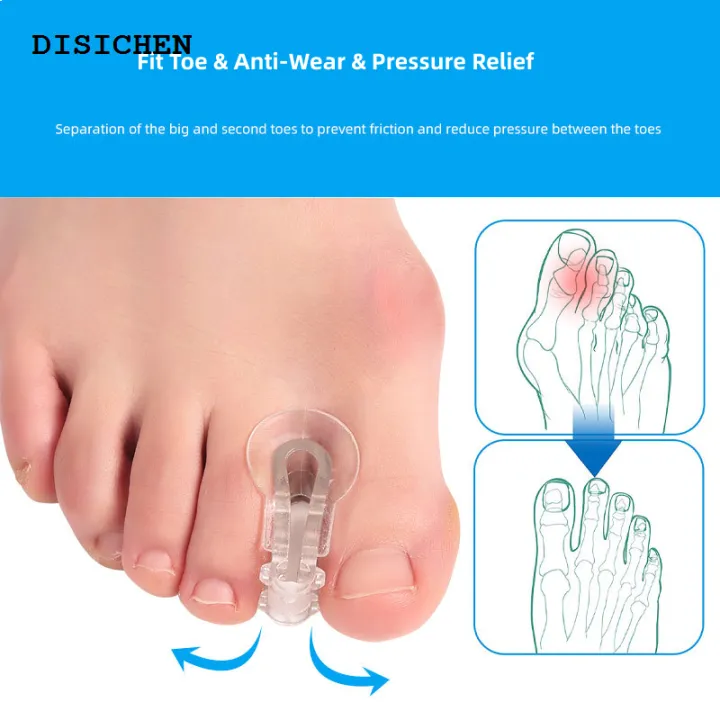 DISICHEN%20Profesional%202pieces=1pair%20Toe%20Orthosis%20Clip%20Pads%20Big%20Foot%20Bone%20Care%20Tools%20Splitter%20Thumb%20Hallux%20Valgus%20Bunion%20Corrector%20Overlap%20Separators%20-%20Image%203