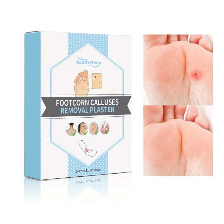 South Moon Pack Of 24 Footcorn Removal Plaster Ideal for Relief and Removal of Corns and Callouses