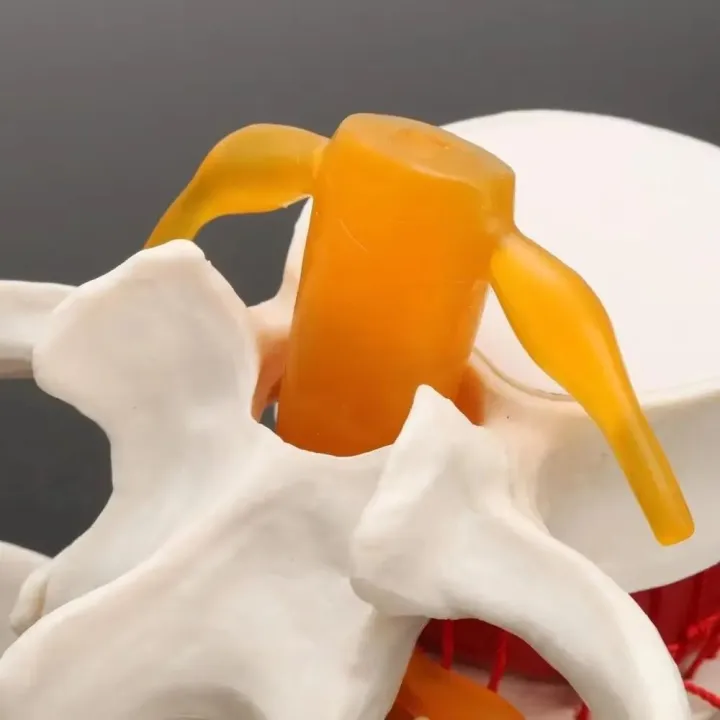 High%20Quality%203D%20Model%20Lumbar%20Model%20Compression%20Demonstration%20.5X%20Enlarge%20Human%20Anatomy%20Skeleton%20Model%20Spinal%20Pressure%20Lesions%20Simulation%20Lumbar%20Disc%20Herniation%20Teaching%20Tool%20Nursing%20-%20Image%205