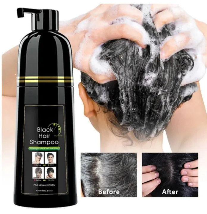 Herbal%202%20in%201%20Hair%20Dye%20Instant%20Black%20Hair%20Shampoo%20for%20Women%20&%20Men%20400ml%20-%20Image%202