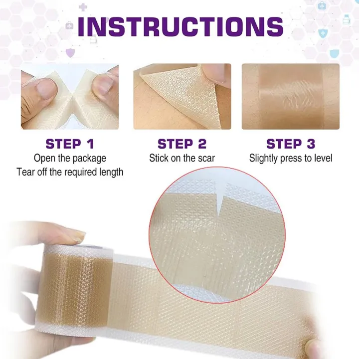 1Roll%20Professional%20Silicone%20Scar%20Sheets%20(Scar%20Tape%20-%20150cm)%20Scars%20Treatment%20-%20Reusable%20Silicone%20Scar%20Strips%20Type%20for%20Keloid,Burn%20-%20Image%206