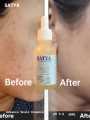 Satya Advance Snail Essence 9-in-1 Skin Solution Serum – 30ml(1 fl.oz.) | With Niacinamide, Vitamins C & E, Salicylic Acid | Hydrating, Anti-Aging & Skin Revitalizing Formula. 
