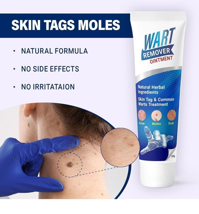 Wart%20Remover%20creaml%20%7C%20Skin%20Tag%20Remover%20cream%20%7C%20massa%20remover%20ointment%20for%20skin%20%7C%20Painless%20Wart%20&%20Skin%20Tag%20Removal%2020g%20-%20Image%203