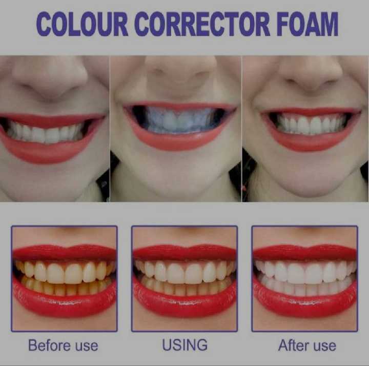 EELHOE%20Colour%20Corrector%20Whitening%20Toothpaste%20-%20Eelhoe%20V34,%20Very%20Effective%20(30ml/1%20fl.oz.)%20-%20Image%204