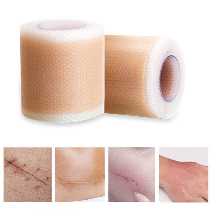 Suture Sticker 4x150cm Efficient Surgery Scar Removal Silicone Gel Tape Sticker Sheet ...