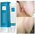Scar Disappearing Skin Repair Cream. 