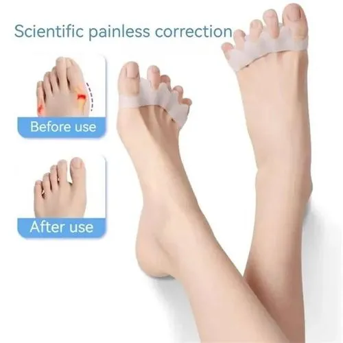 Bunion%20Corrector%20for%20Pain%20Relief%20and%20Toe%20Alignment%20%7C%20Comfortable%20Foot%20Support%20-%20Image%202