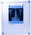 Led  X-Ray View Box Single Film With Dimmer. 