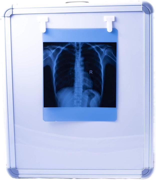 Led%20%20X-Ray%20View%20Box%20Single%20Film%20With%20Dimmer%20-%20Image%203