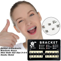 10Pack Model Metal Brackets Braces 018 Slot 345 Hooks Tooth Gem Kit Tooth Braces. 
