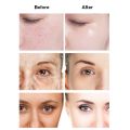 100ml Anti Aging Original 24K Gold Serum For Smooth Facing/Pimple Removal. 
