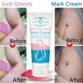 Aichun Beauty Whitening Stretch Marks Repair Cream Scar Repair Maternity Repair To Nourishing Cream Moisturizer Growth Lines Massage Skin Body-60g. 