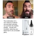 Fast Hair Growth Serum Beard Oil Axillary and Chest Hair Regrowth Fluid Longer Thicker Preventing alopecia Anti-Hair Loss. 