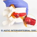 Use 3D Model Lumbar Model Compression Demonstration Spinal Pressure Lesions Human Anatomy Skeleton Model Educational Tool Simulation Spine Demonstration Structure Student. 