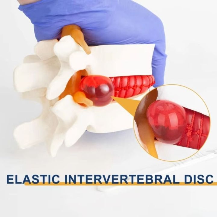 Use%203D%20Model%20Lumbar%20Model%20Compression%20Demonstration%20Spinal%20Pressure%20Lesions%20Human%20Anatomy%20Skeleton%20Model%20Educational%20Tool%20Simulation%20Spine%20Demonstration%20Structure%20Student%20-%20Image%204