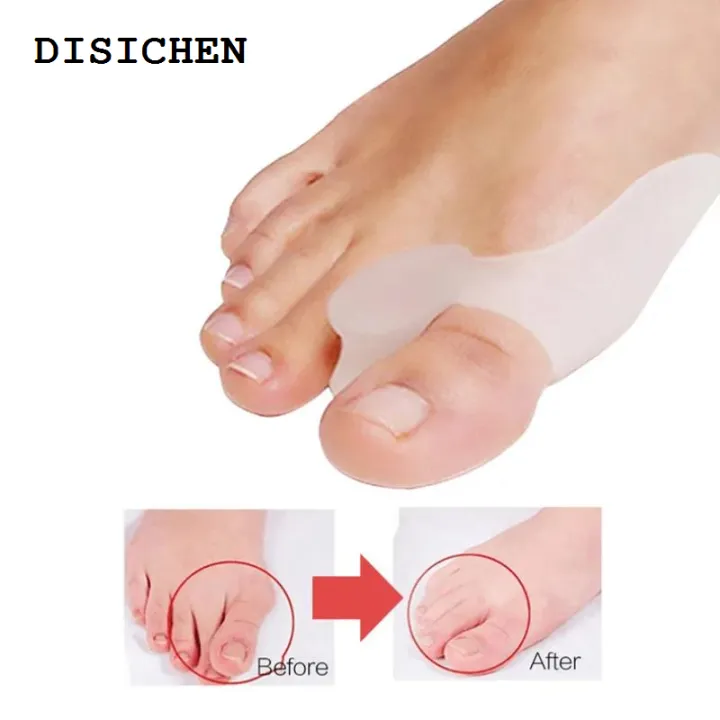 DISICHEN%202Pcs=1Pair%20Silicone%20Toes%20Separator%20Bunion%20Bone%20Ectropion%20Adjuster%20Toes%20Outer%20Appliance%20Foot%20Care%20Tools%20Hallux%20Valgus%20Corrector%20-%20Image%203