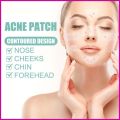 200 Patches Acne Cover  Pimple Patches for Face, Hydrocolloid Acne Patches, Cute Star Zit Covers for Face. 