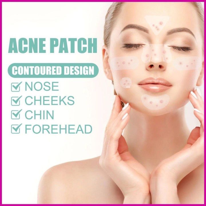 200%20Patches%20Acne%20Cover%20%20Pimple%20Patches%20for%20Face,%20Hydrocolloid%20Acne%20Patches,%20Cute%20Star%20Zit%20Covers%20for%20Face%20-%20Image%206