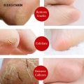 DISICHEN Special 1PC Foot Pumice Stone Sponge Block Callus Remover for Feet Hands Scrub Manicure Nail Tools Professional Pedicure Foot Care Tools. 