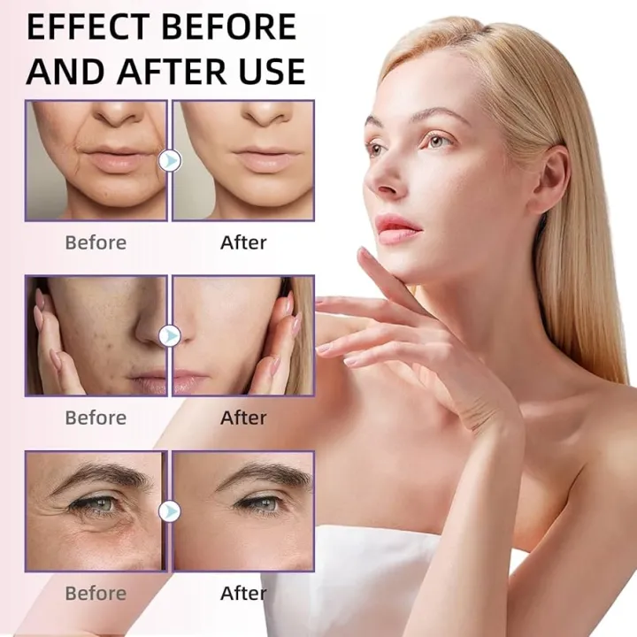 Madagascar%20Centella%20Ampoule%20Facial%20Serum%20%7C%2030ml%20%7C%20For%20Soothing%20Sensitive%20And%20Acne-prone%20Skin%20-%20Image%206